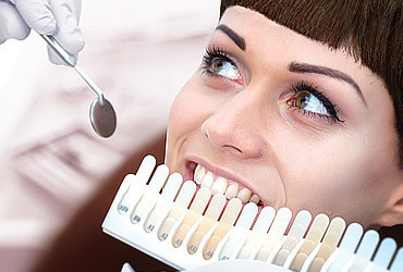 Эстетическая стоматология